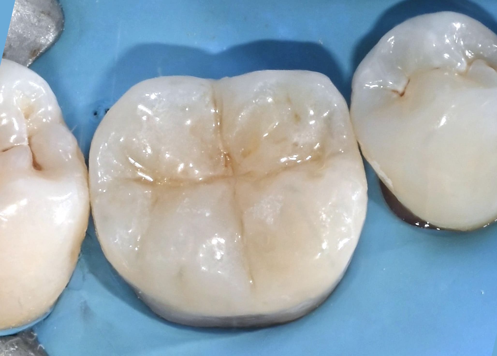 Dr Allain Clémence – chirurgienne-dentiste esthétique Nice