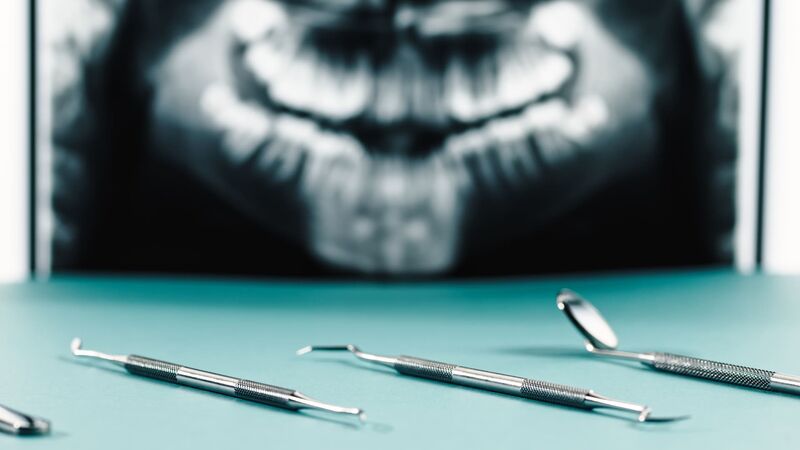 Instruments dentaires et radiographie - greffes osseuses Nice