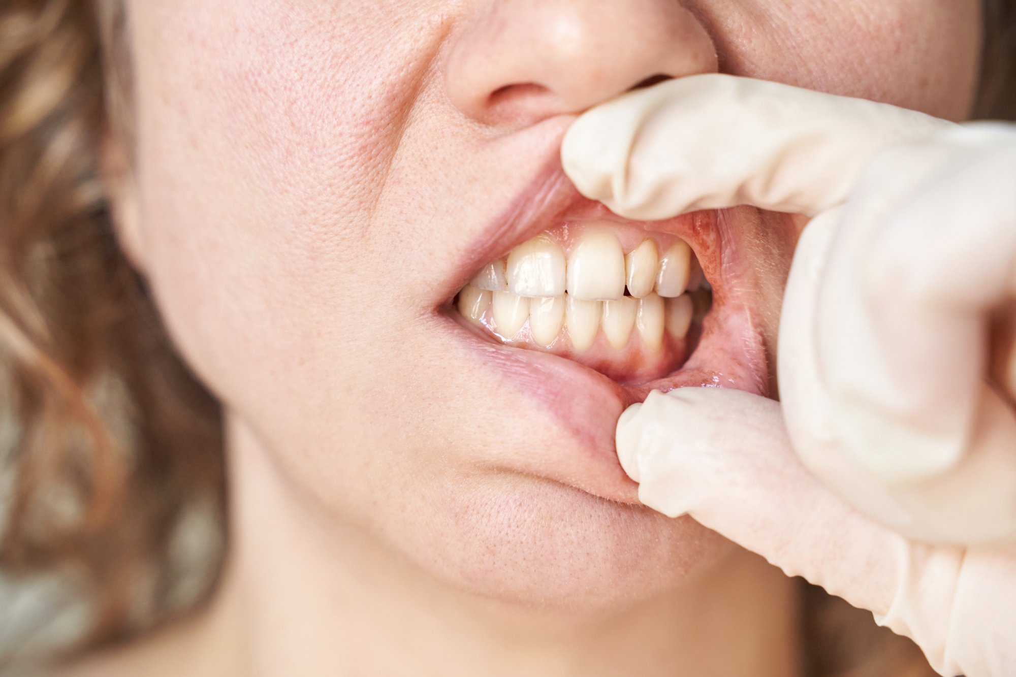 Fauteuil dentaire cabinet Charbit Nice - Parodontologie