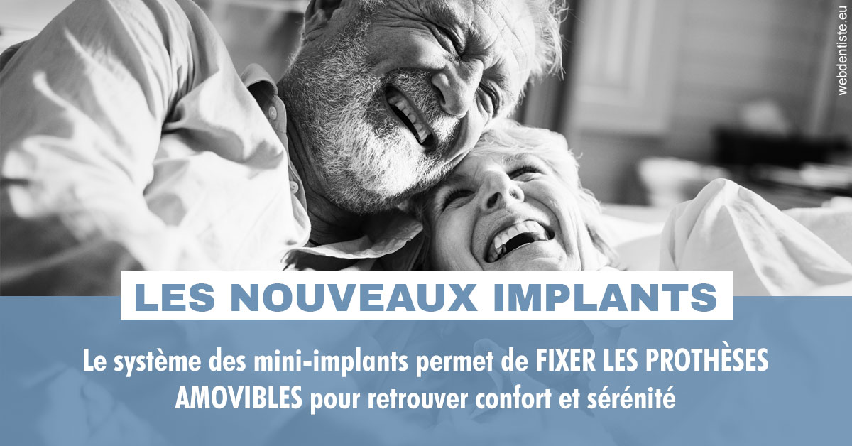 https://www.cabinet-dentaire-charbit.fr/Les nouveaux implants 2