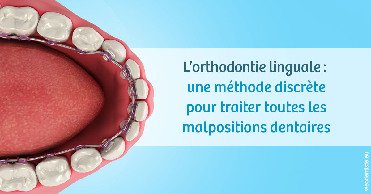 https://www.cabinet-dentaire-charbit.fr/L'orthodontie linguale 1