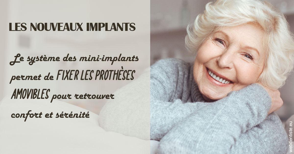 https://www.cabinet-dentaire-charbit.fr/Les nouveaux implants 1
