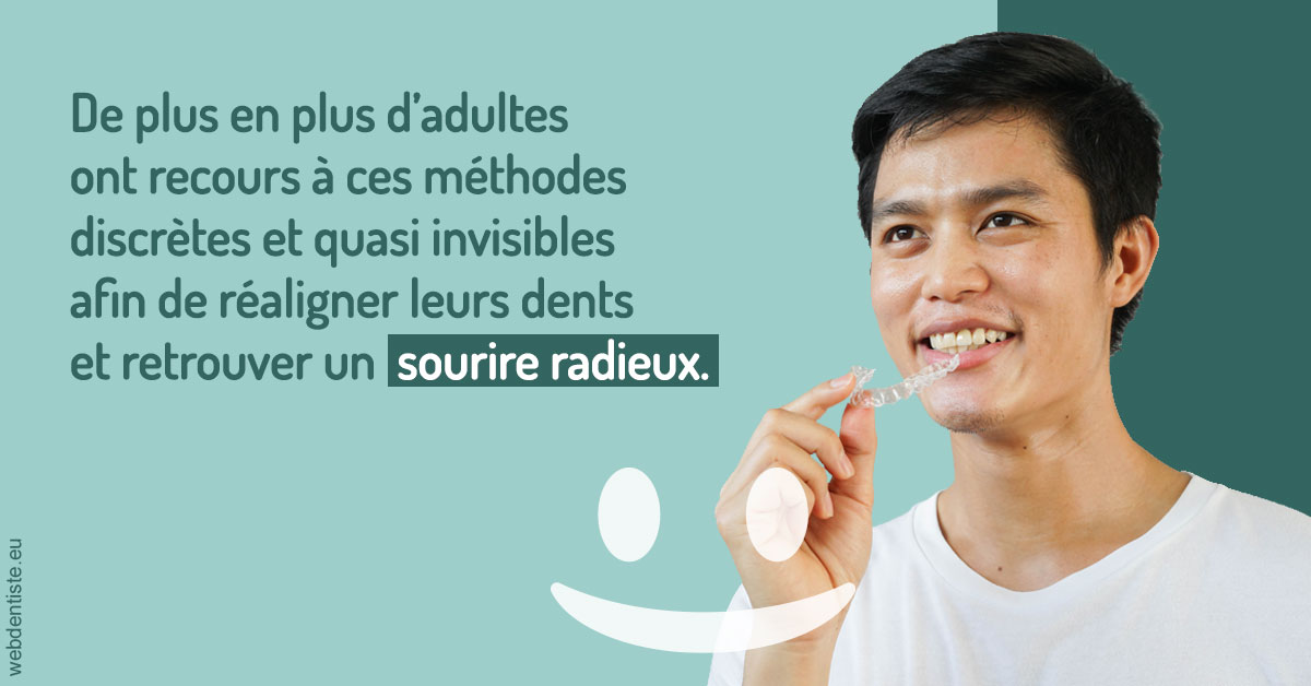 https://www.cabinet-dentaire-charbit.fr/Gouttières sourire radieux 2