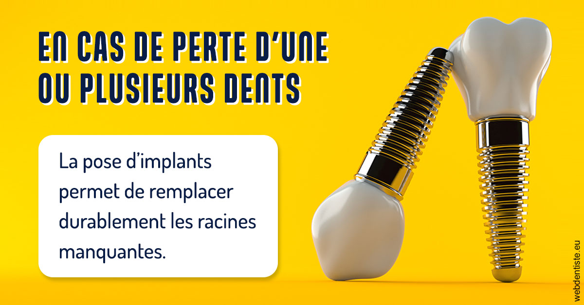 https://www.cabinet-dentaire-charbit.fr/2024 T1 - Implants 02