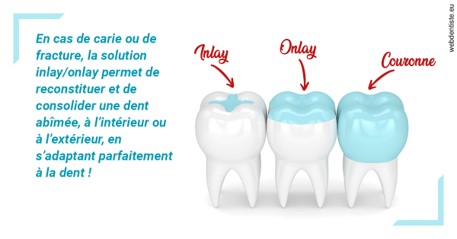 https://www.cabinet-dentaire-charbit.fr/L'INLAY ou l'ONLAY