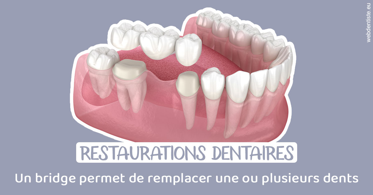 https://www.cabinet-dentaire-charbit.fr/Bridge remplacer dents 1