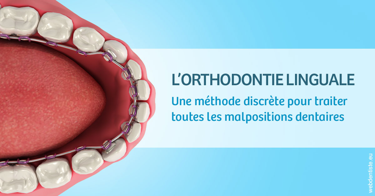 https://www.cabinet-dentaire-charbit.fr/L'orthodontie linguale 1