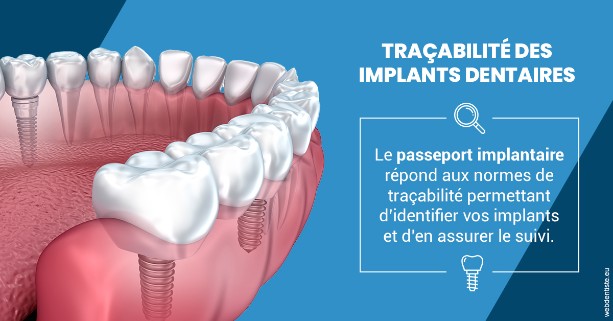 https://www.cabinet-dentaire-charbit.fr/T2 2023 - Traçabilité des implants 1