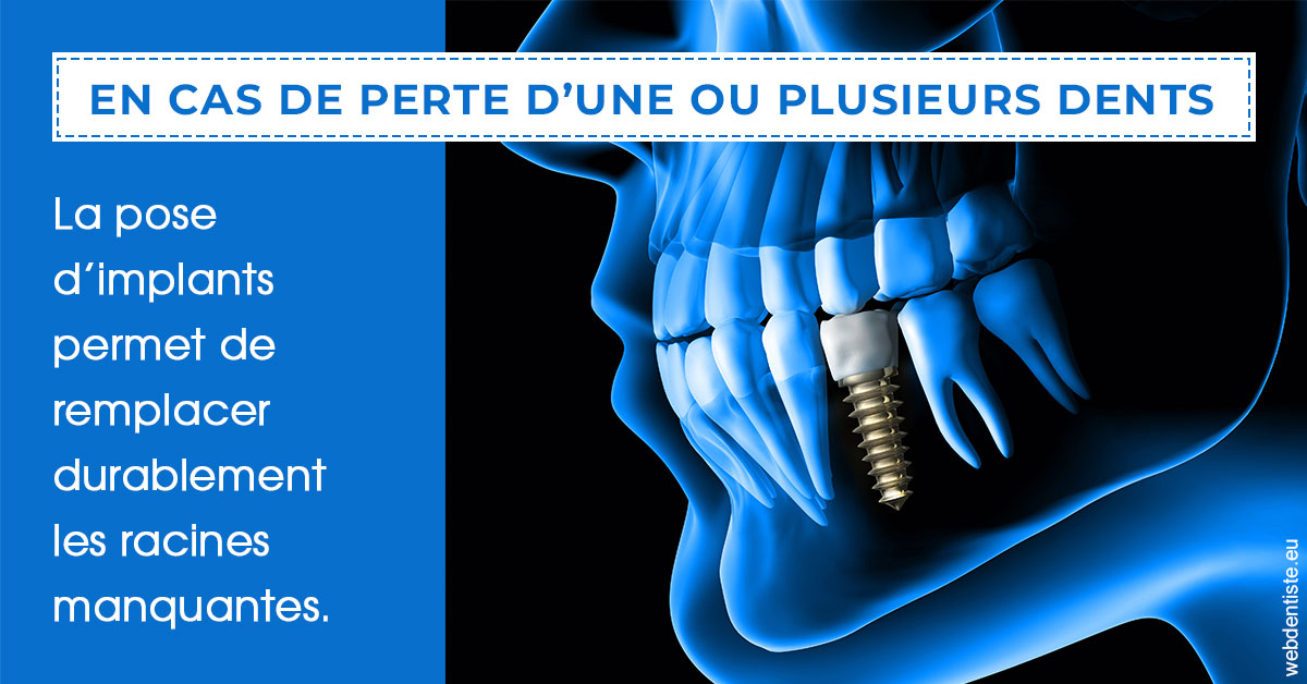 https://www.cabinet-dentaire-charbit.fr/2024 T1 - Implants 01