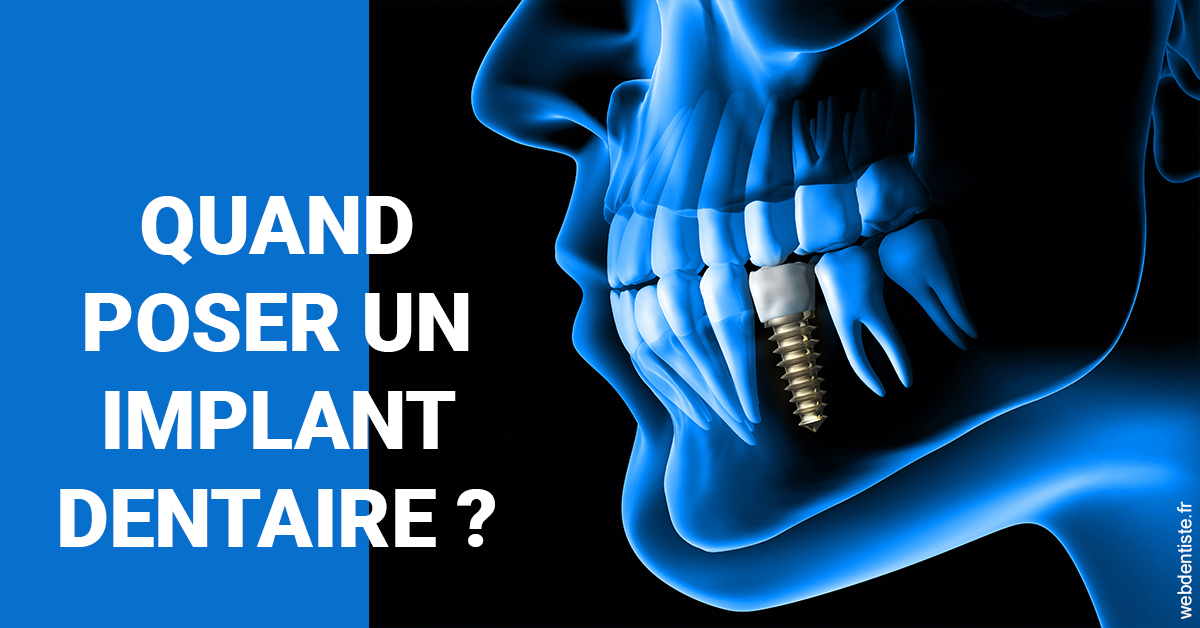 https://www.cabinet-dentaire-charbit.fr/Les implants 1