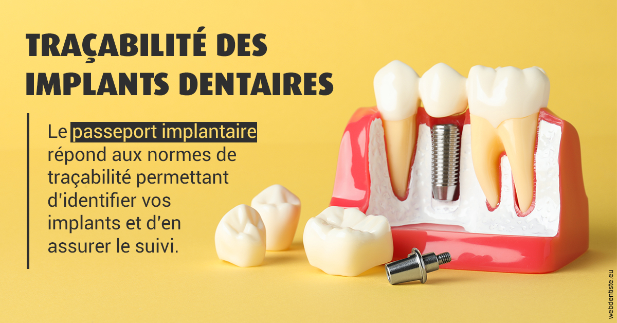 https://www.cabinet-dentaire-charbit.fr/T2 2023 - Traçabilité des implants 2