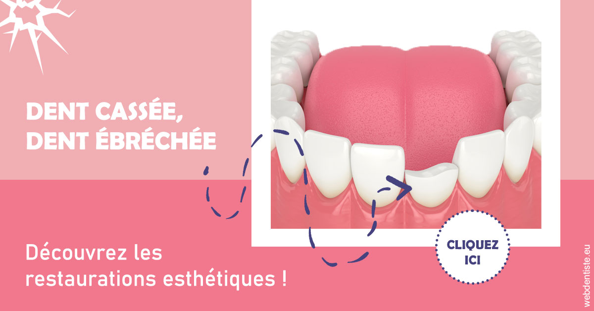 https://www.cabinet-dentaire-charbit.fr/Dent cassée ébréchée 1
