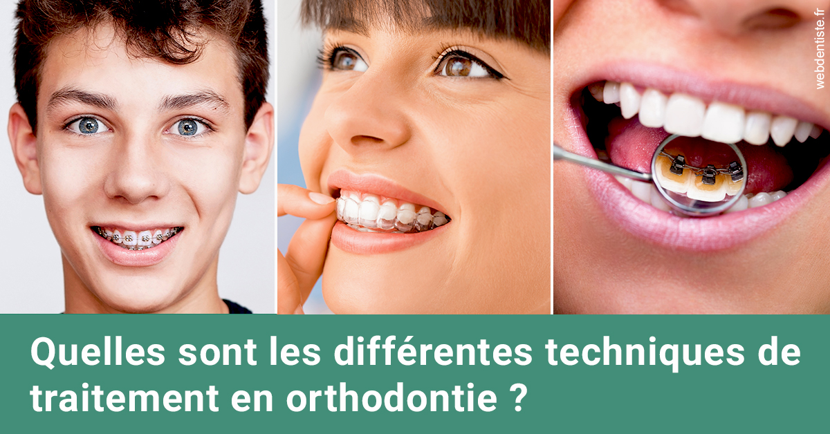 https://www.cabinet-dentaire-charbit.fr/Les différentes techniques de traitement 2