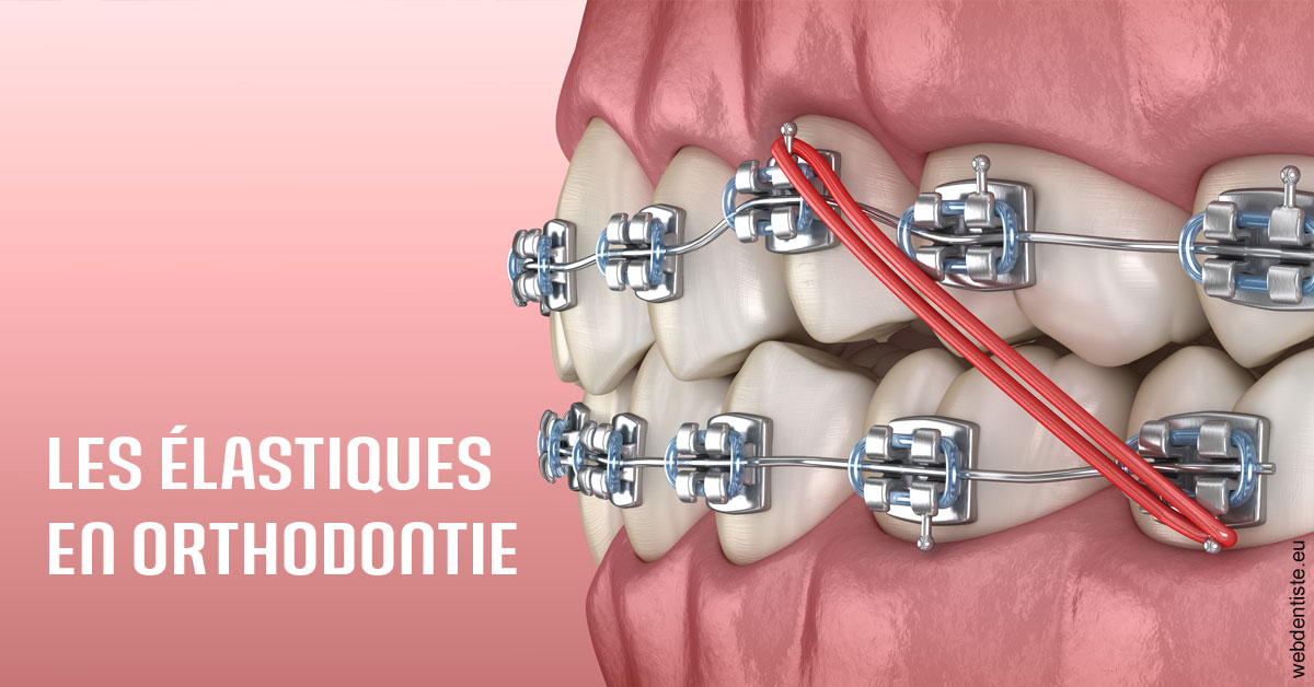 https://www.cabinet-dentaire-charbit.fr/Elastiques orthodontie 2
