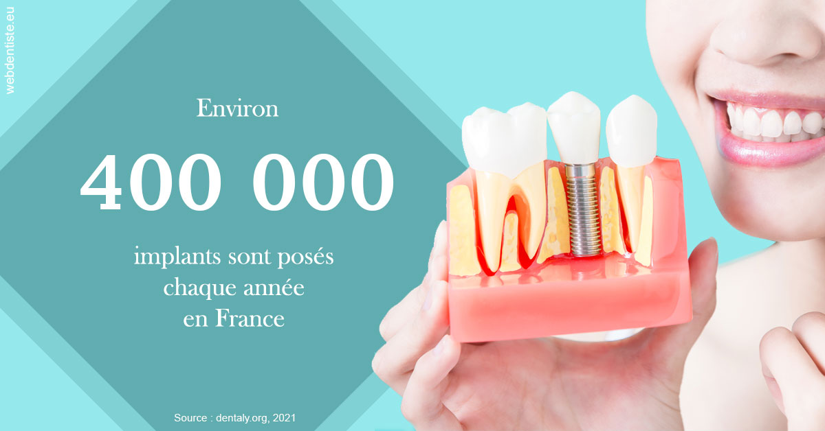 https://www.cabinet-dentaire-charbit.fr/Pose d'implants en France 2