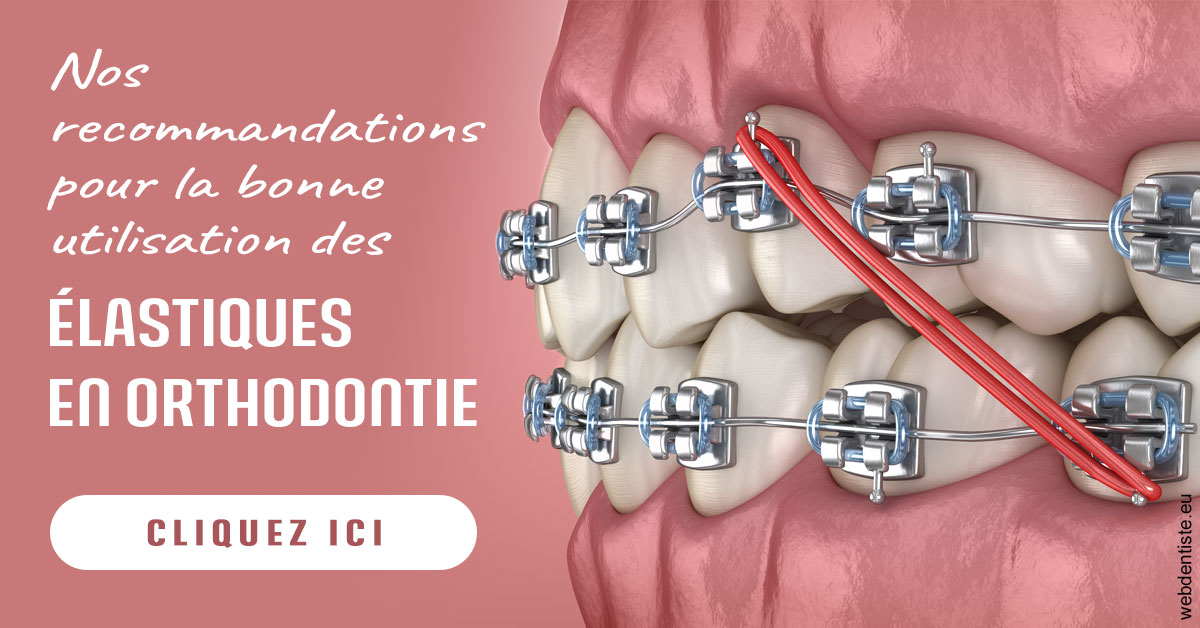 https://www.cabinet-dentaire-charbit.fr/Elastiques orthodontie 2
